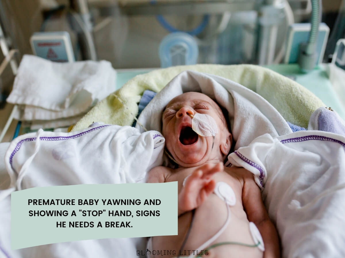 10 Unexpected Ways Your NICU Baby Is Telling You They Are Stressed ...